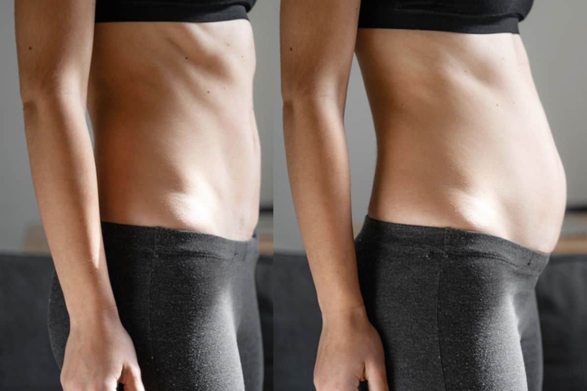 How long does diastasis recti take to improve Greater London (Tower Hamlets)?
