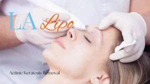 Woman receiving Actinic Keratosis Removal Treatment Greater London (Tower Hamlets)