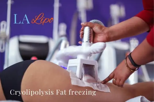 women getting fat freezing Greater London (Tower Hamlets)