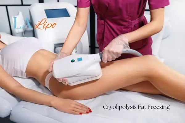 Woman receiving coolsculpting Greater London (Tower Hamlets) treatment on her thighs
