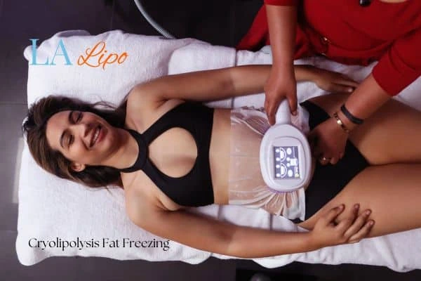 woman getting cryolipolysis Greater London (Tower Hamlets)