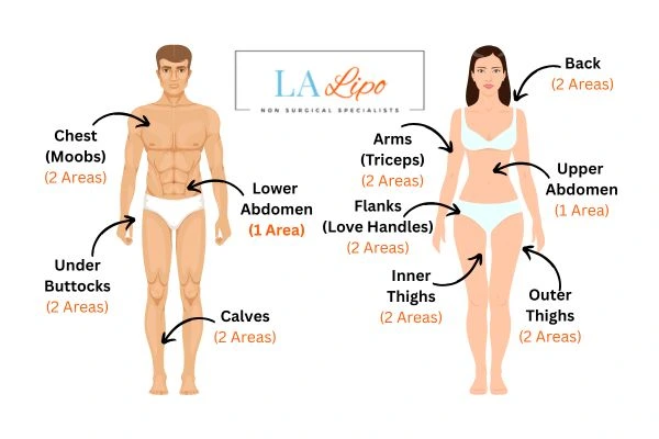 LA LIPO Cryolipolysis Areas Greater London (Tower Hamlets)