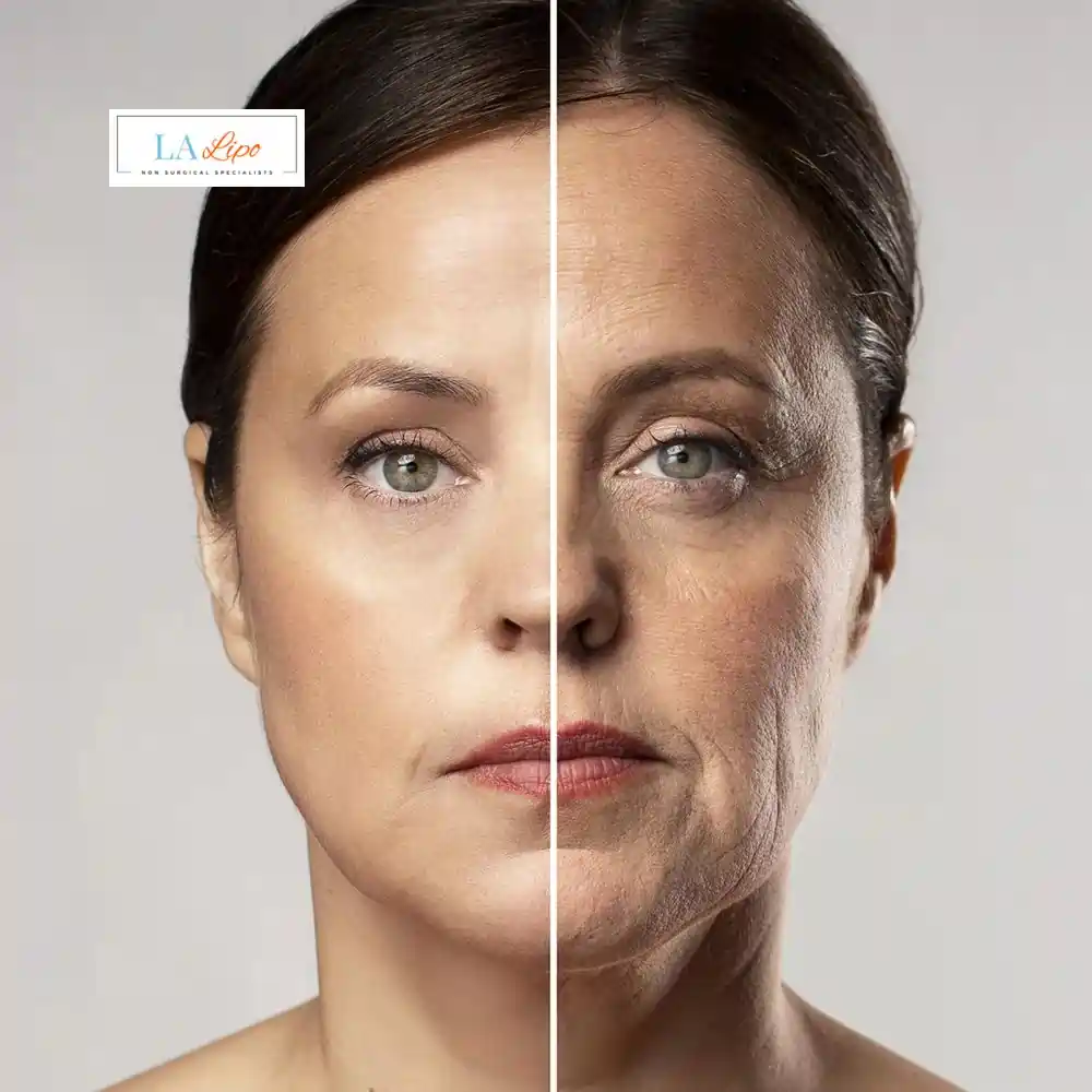 How Can You Tell If Non-Surgical Skin Tightening Is Right for You Greater London (Tower Hamlets)?