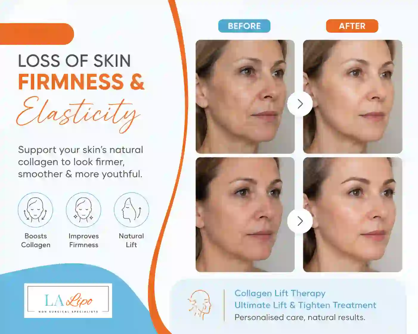 Sign #7: Loss of Skin Firmness and Elasticity Greater London (Tower Hamlets)